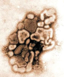（圖）H1N1亞型豬流感病毒