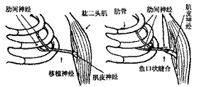 肋間外膜