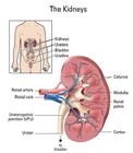 系膜毛細血管增生性腎炎