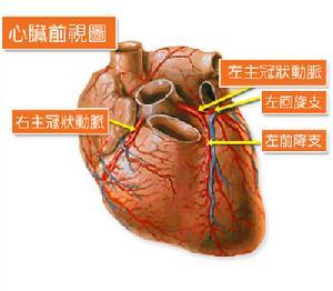 缺血性心肌病