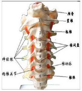 神經根型頸椎病