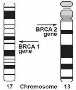 BRCA1基因