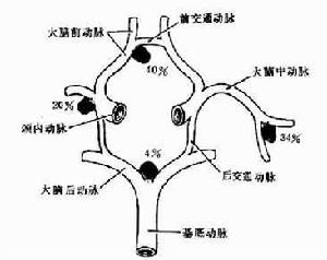 基底動脈