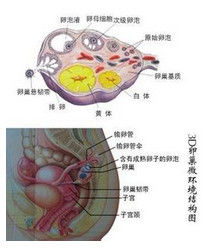 右側卵巢囊腫