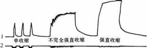 強直收縮