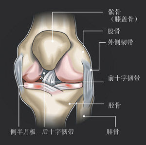 髕骨勞損