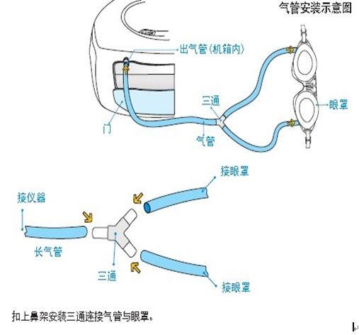 氣管安裝示意圖