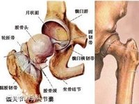 DSA介入融通療法