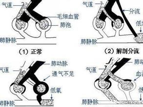 肺泡通氣量