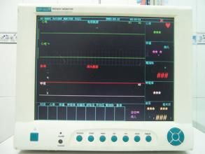 心電監護儀