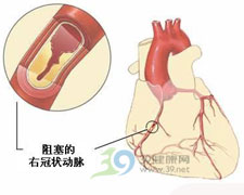 鹽酸普萘洛爾緩釋膠囊