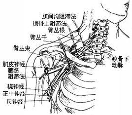 臂神經痛