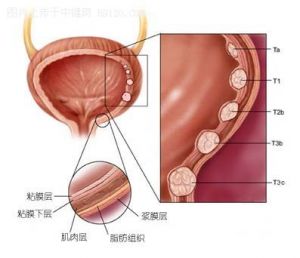 免疫抑制作用