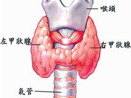 碘甲狀腺功能亢進症