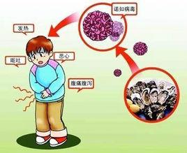 12·25廣州81名學生諾如病毒感染事件