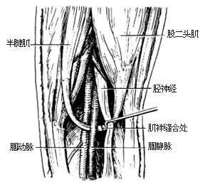 下肢靜脈功能不全