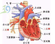 先天性主動脈縮窄