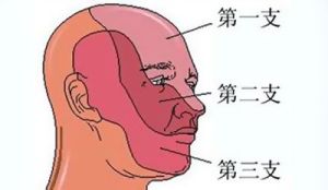 鼻旁竇支氣管綜合徵