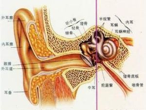 膽脂瘤型中耳炎