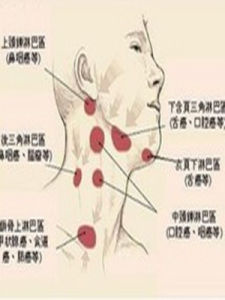 頸下淋巴結腫大