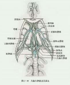 腦血管痙攣