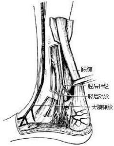 跟腱周圍炎