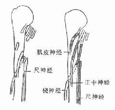 橈神經麻痹