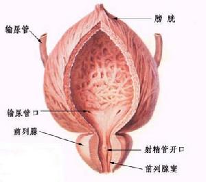 前列腺腫瘤