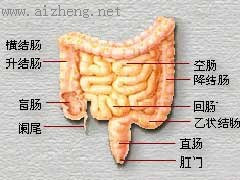 腸神經官能症