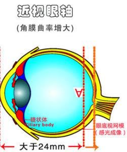 近視眼