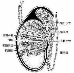 睪丸囊腫