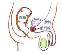 尿道病損切除術