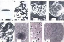 疵壁菌門類的各種古細菌的形態和大小