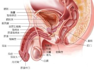 膀胱尿道異物
