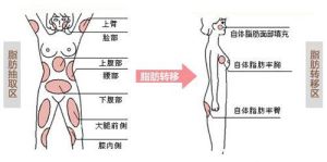 儷顏超微自體活細胞移植