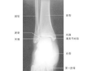 《踝足傷病診治手冊》