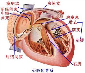 高度房室傳導阻滯