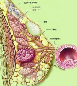 囊腺瘤