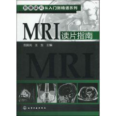 MRI讀片指南