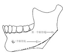 下頜角