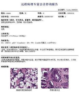 病理診斷報告