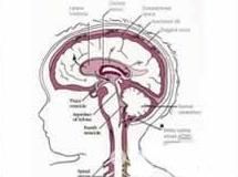 小腦扁桃體下疝畸形