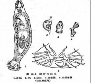 鞘狀指環蟲