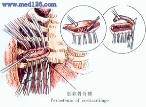 （圖）治療