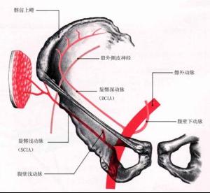 皮瓣移植