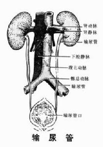 尿路感染