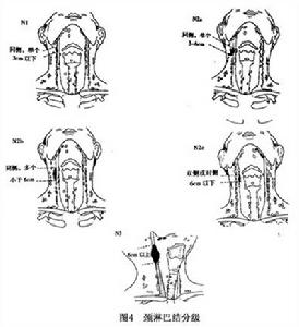 頸部淋巴結轉移癌