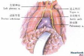 動脈導管三角