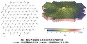 特發性黃斑裂孔