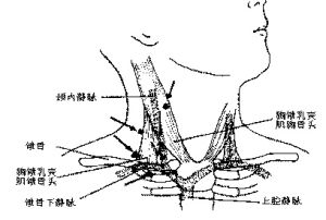 中心靜脈置管